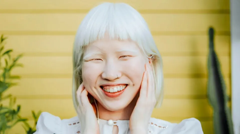 Can Albino People Dye Their Hair? Everything You Need to Know