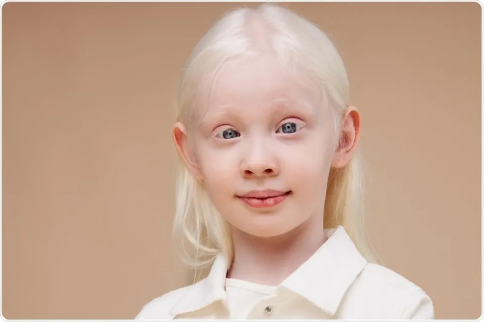 Color Albino Hair