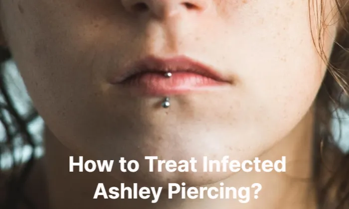 How To Treat Infected Ashley Piercing Full Guide After Sybil 