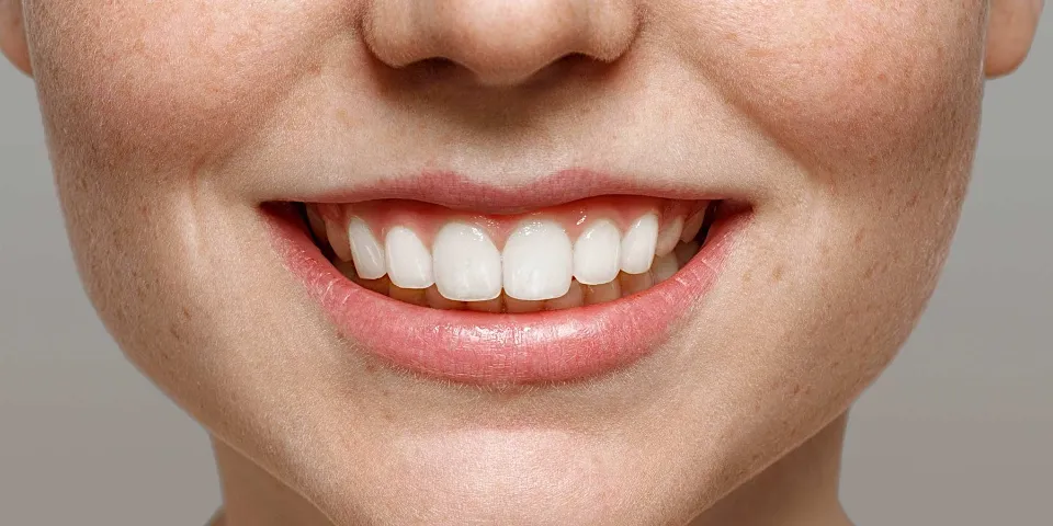 Do Whitening Strips Damage Enamel