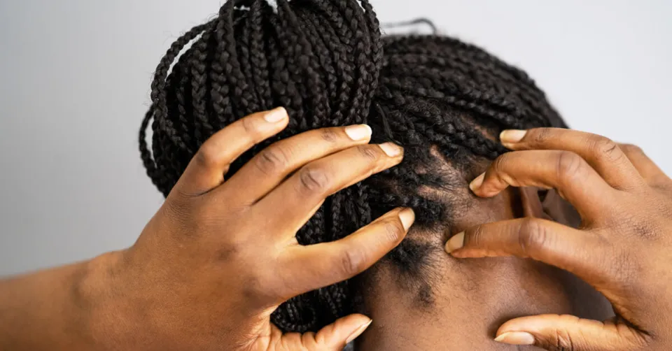 How to Care for Box Braids