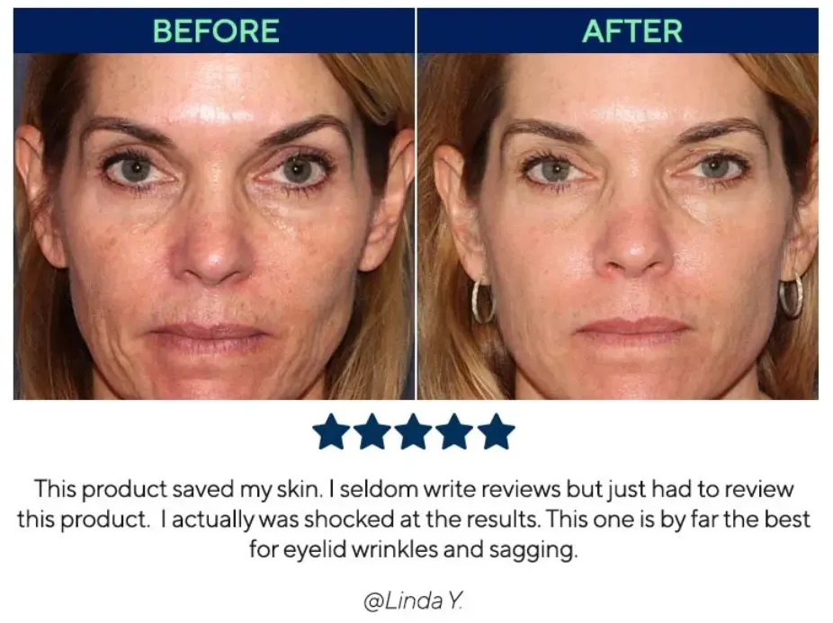 fillhage reviews before and after