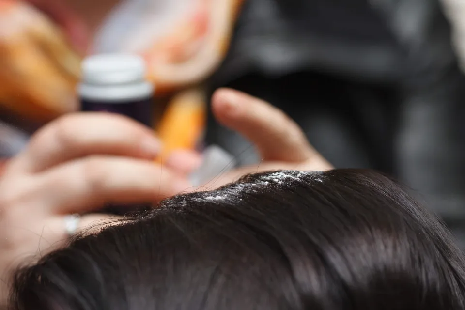 Is Dry Shampoo Bad for Your Scalp