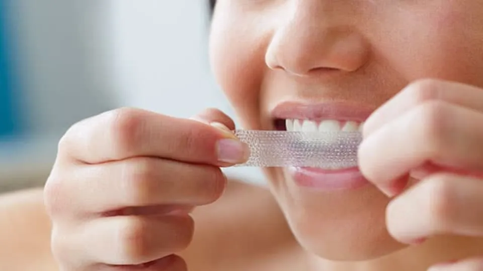 should you brush your teeth after whitening strips