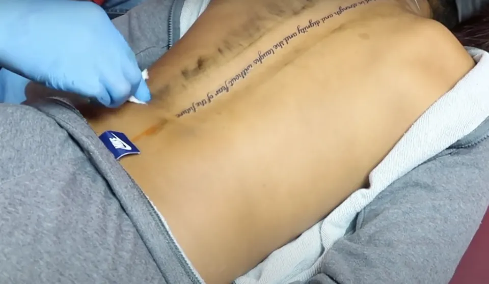 Can a Spine Tattoo Paralyze You