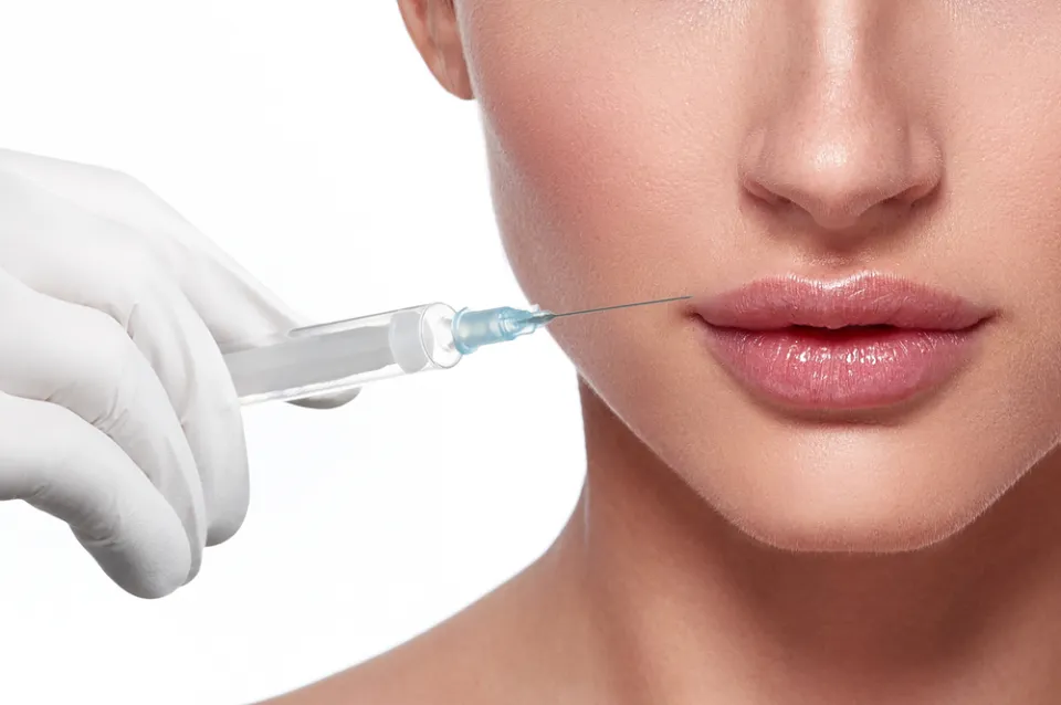 What Not to Do After Lip Filler