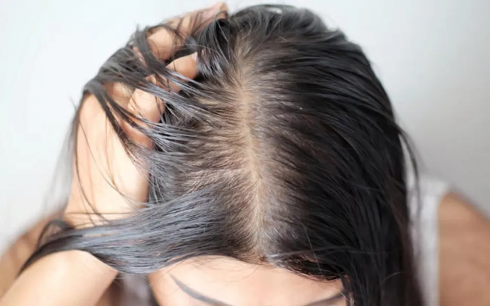 Why is My Hair So Oily? (With 9 Reasons)