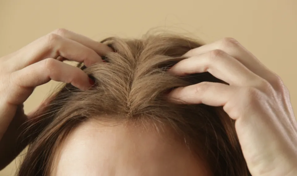 Can Dry Scalp Cause Hair Loss? Causes & Treatments