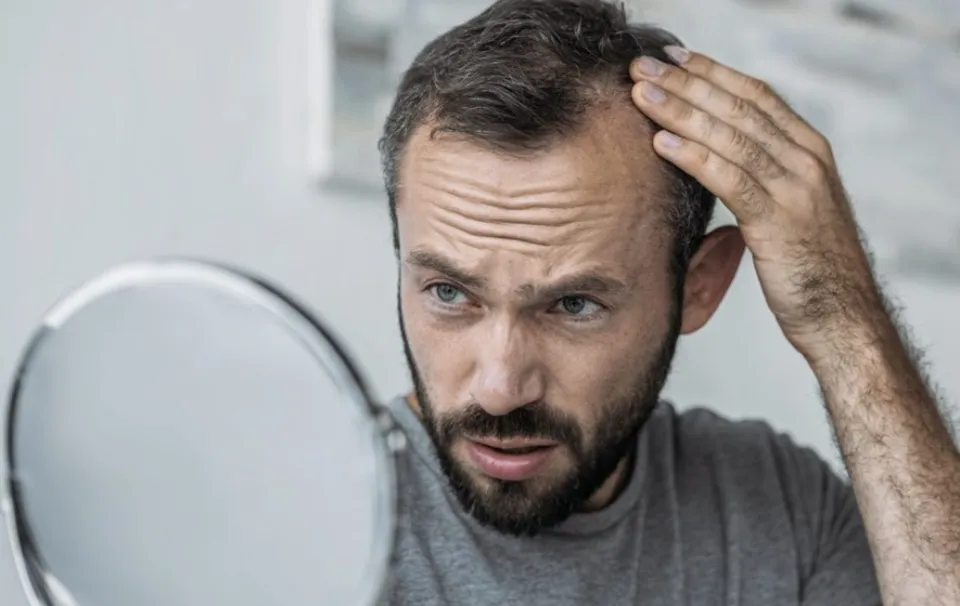 Does Amlodipine Cause Hair Loss