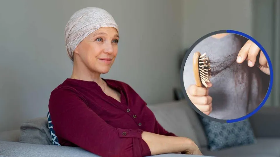 Does Cancer Cause Hair Loss? Facts to Know