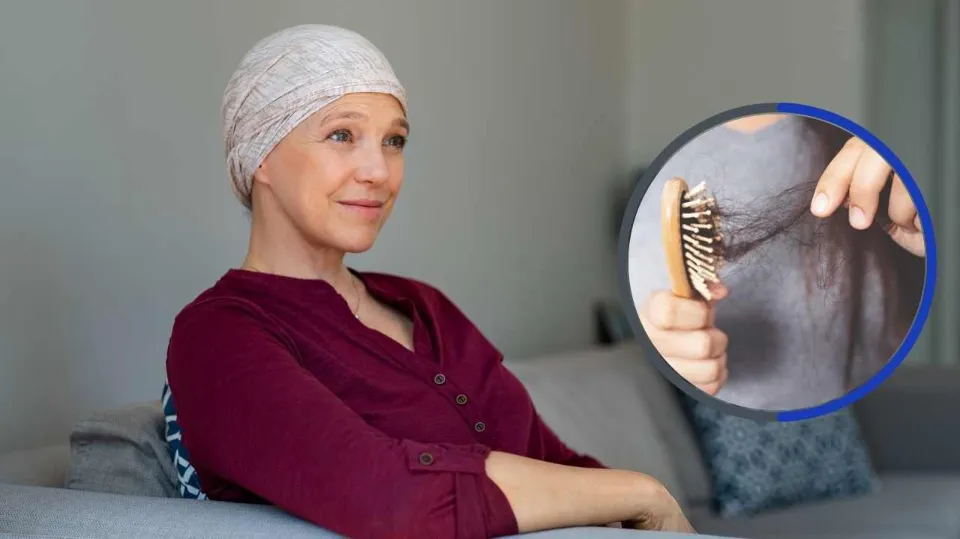 Does Cancer Cause Hair Loss