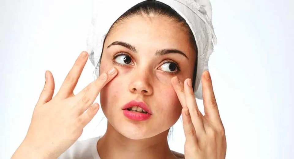 How to Treat Dry Skin Around Eyes