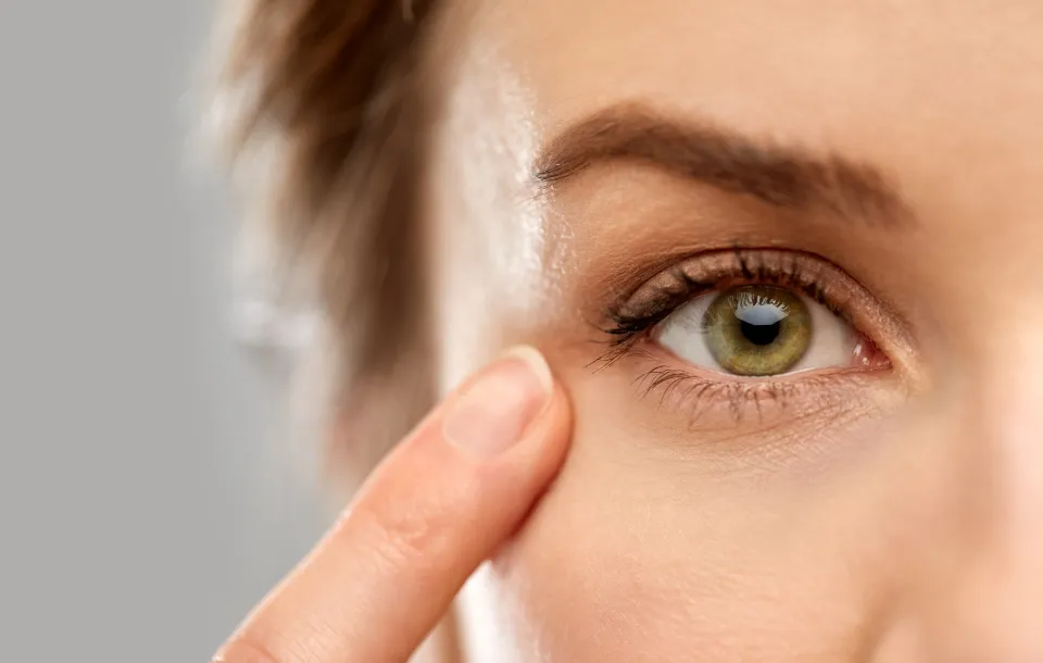 How to Treat Dry Skin Around Eyes