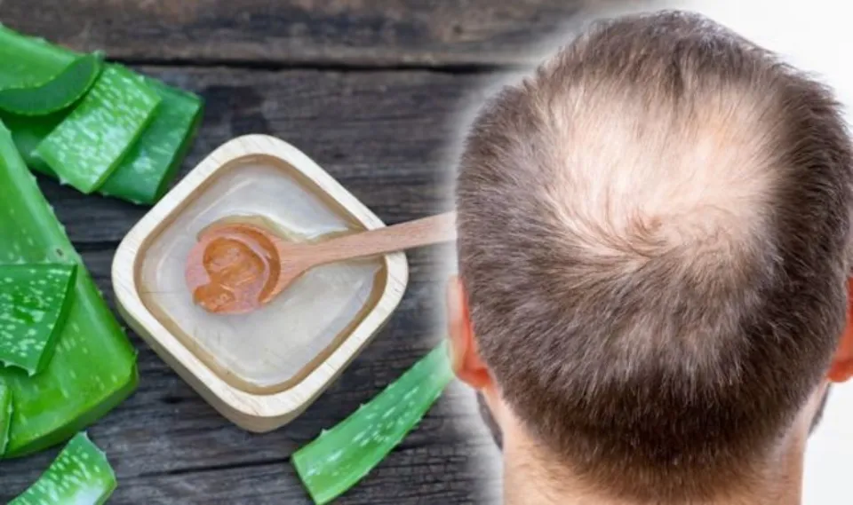 Can Aloe Vera Cause Hair Loss? Facts to Know