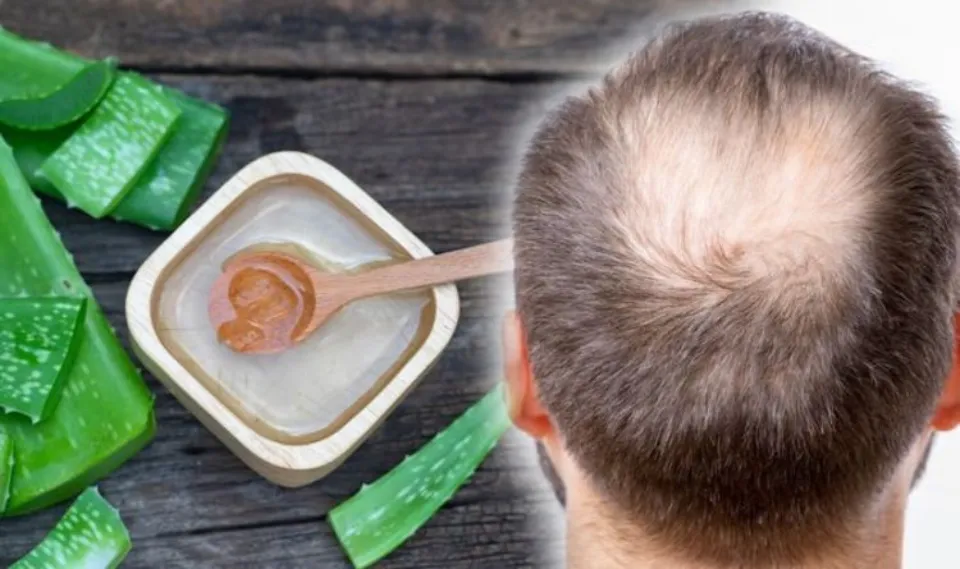 Can Aloe Vera Cause Hair Loss