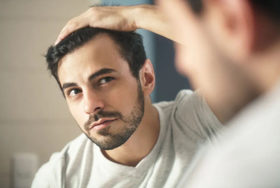 Do Steroids Cause Hair Loss