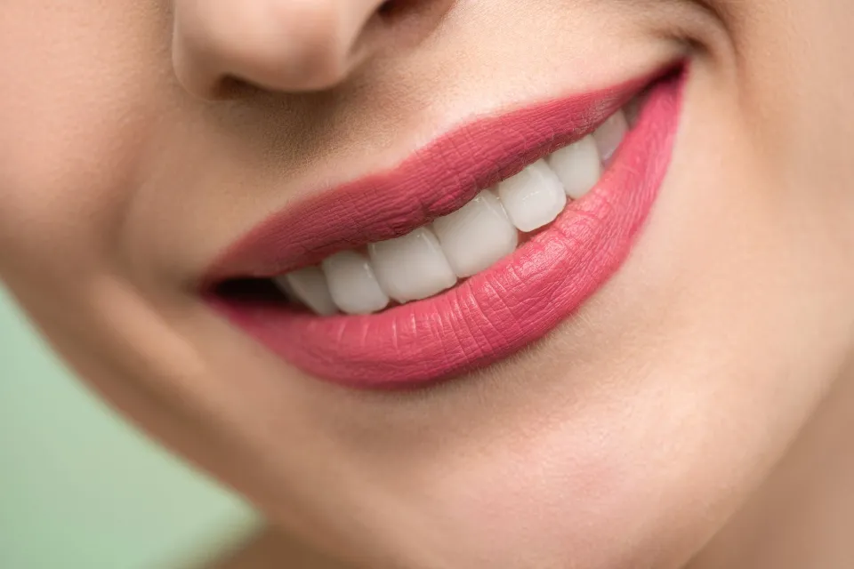 How Long Does It Take to Whiten Teeth