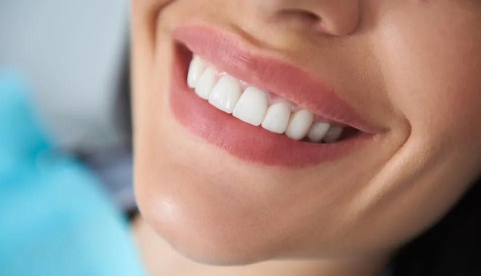 How Often Should You Whiten Your Teeth? Facts to Know