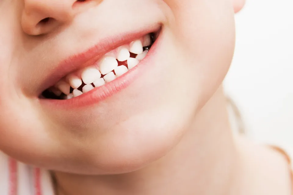 How to Whiten Kids Teeth? 4 Easy Home Methods