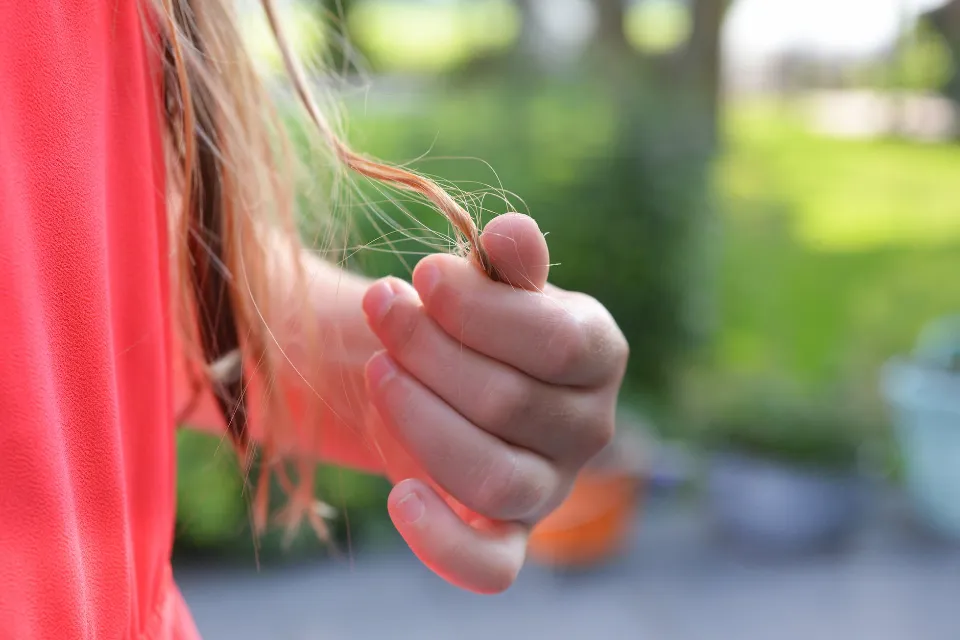 Is Hair Loss Genetic? Facts to Know