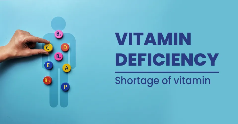 Which Vitamin Deficiency Causes Hair Loss? Find Out More!