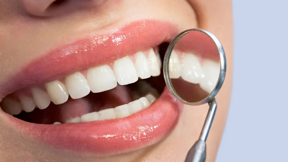 Can Bonded Teeth Be Whitened? | District Dentistry Charlotte