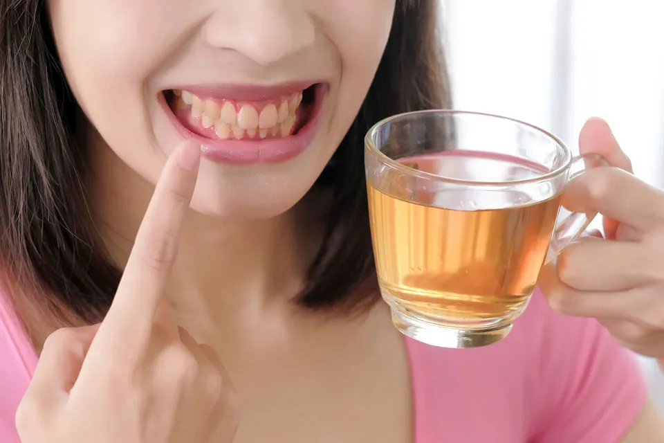 Do Coffee and Tea Really Stain Our Teeth Yellow?