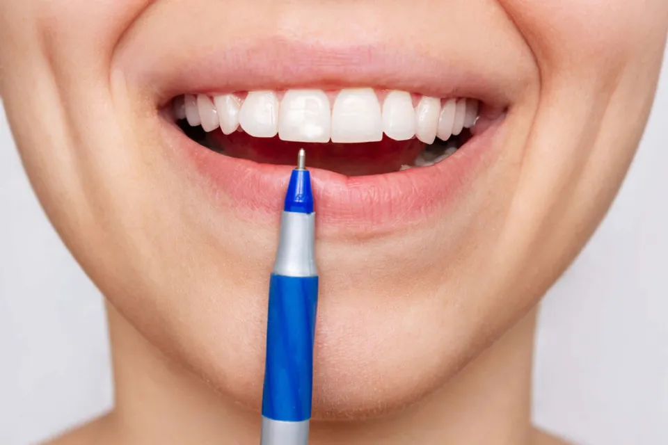 How to Get Rid of White Spot on Teeth? Complete Guide