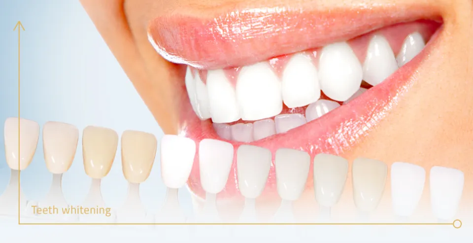How to Whiten Fake Teeth