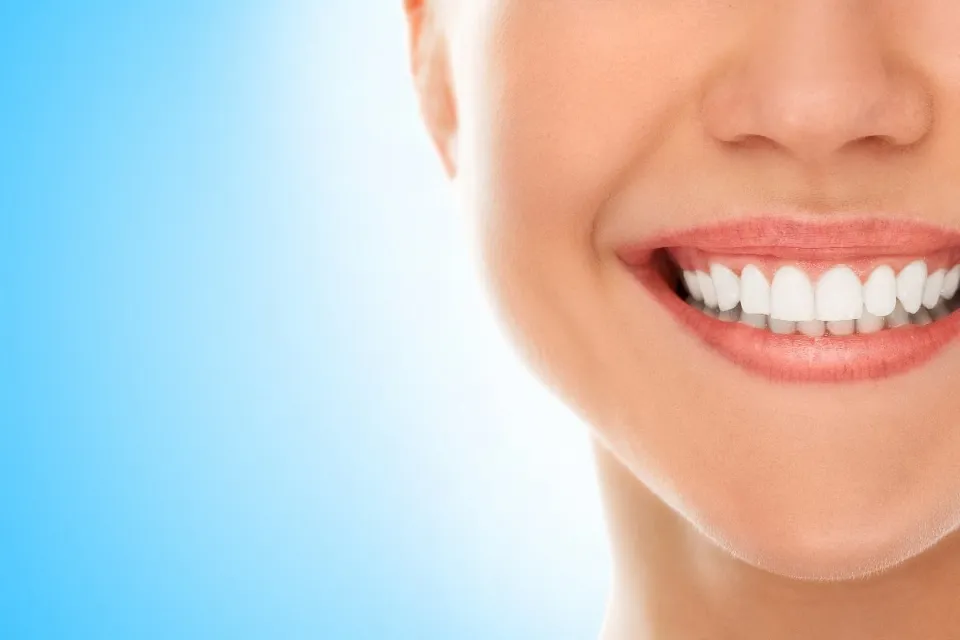 What is Teeth Bonding