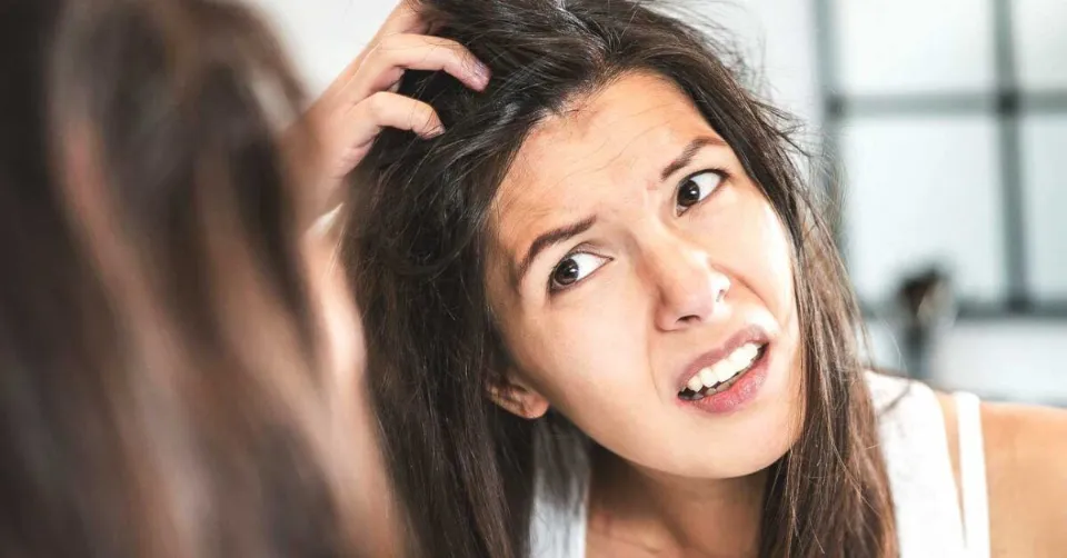 How to Get Rid of Dandruff? 10 Proven Ways