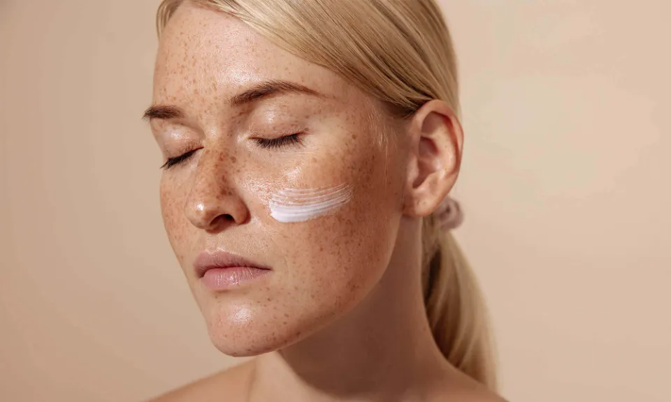 Does Sunscreen Help Acne? Here’s Everything You Need to Know