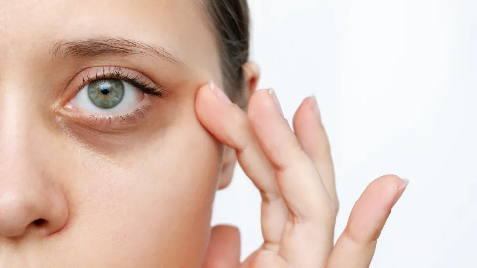 How to Cover Dark Circles